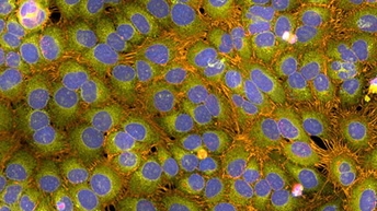 Kits de Cell Painting